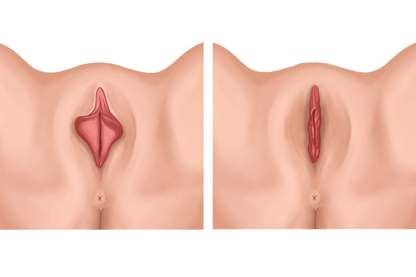 Cirurgia Intima especialista sp