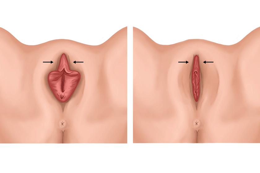 Cirurgia Intima especialista sp